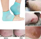 Silicone Gel Heel Pad 
