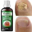 Nail Fungus Treatment Oil (30 ml)