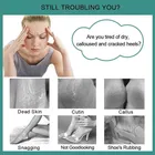 SHAGUN 4 in1 Pedicure Scrubber, Pack of 1 