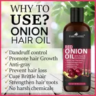 Park Daniel Red Onion Oil for Hair Regrowth & Anti Hair Fall 