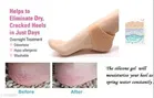 Silicone Pain Relief Heel Socks for Unisex 