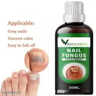 Vedulekha Nail Fungus Treatment Oil (30 ml)