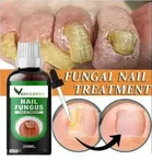 Vedulekha Nail Fungus Treatment Oil 