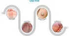 Corn Caps Adhesive Band Aid 