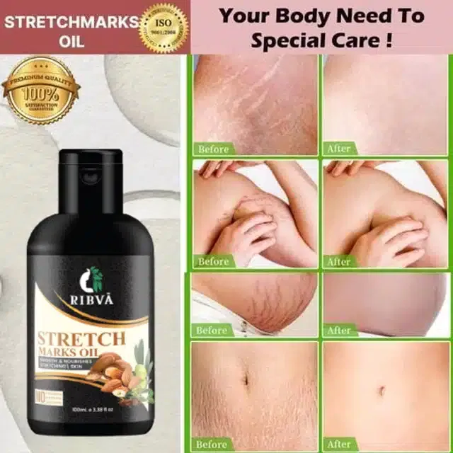Ribva Stretch Marks Removal Oil (100 ml)