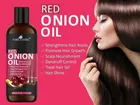 Park Daniel Red Onion Oil for Hair Regrowth & Anti Hair Fall 