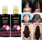 Phillauri Onion with Black Seed Oil 