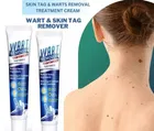 Wart Remover Cream 