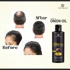 Premium Onion Hair Oil (100 ml)