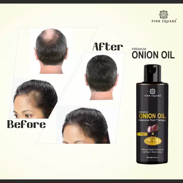 Premium Onion Hair Oil (100 ml)