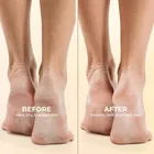 बायोलाइन क्रैक हील फुट क्रीम 150 मि.ली.