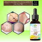 Haria Naturals Anti-Stretch Marks Skin Oil Reduces Stretch Marks & Heal Scars 