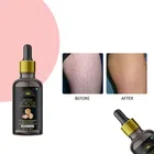 Stretch Mark Removal Oil (30 ml)