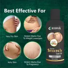 Ribva Stretch Marks Removal Oil 