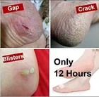 Silicone Gel Heel Socks 