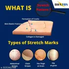 Phillauri Stretch Marks Creams for Men & Women 