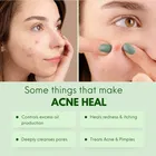 Qraa एक्ने क्लियरिंग फेस वॉश 50 ml