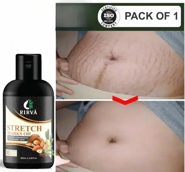 Ribva Stretch Marks Oil (100 ml)