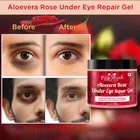 Pink Root Aloevera Rose Under Eye Gel (100 ml)