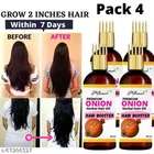 Phillauri Onion Herbal Hair Oil 
