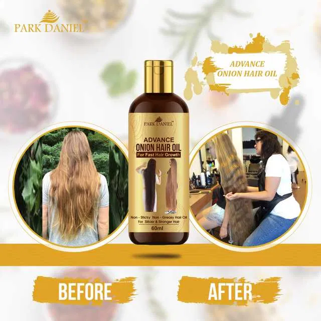 Park Daniel Advanced Onion Hair Oil for Hair Fall Control (60 ml) (SE-120)