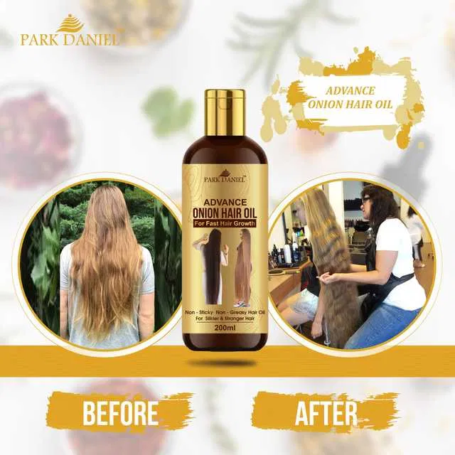 Park Daniel Advanced Onion Hair Oil for Reduces Hair Fall Control (200 ml) (SE-1575)
