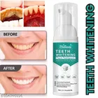 Phillauri Teeth Whitening Foam 
