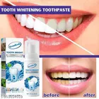 Growkesh Teeth Whitening Foam 