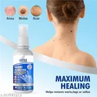 KRIKA Wart Remover Ointment 