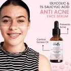 Globus Remedies Glycolic & 1% Salicylic Acid Anti Acne Face Serum 50 g