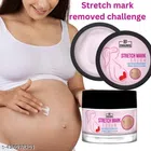 Enauniq Stretch Marks Removal Cream (50 g)