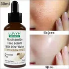 Luvyh Niacinamide Face Serum (30 ml)