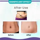 Fuvara Stretch Marks Removal Oil 