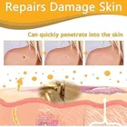 Bee Venom Remover Spray 