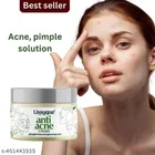  Lissyque Anti Acne Cream for Reduce Acne, Soothe Skin, And Gentle & Effective Formula for All Skin Types