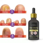 Fungus Treatment Liquid for Nails  