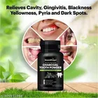 Smartdrops Teeth Whitening Foam Toothpaste Makes You Reveal Perfect, Natural Whitening Foam Toothpaste Mousse 