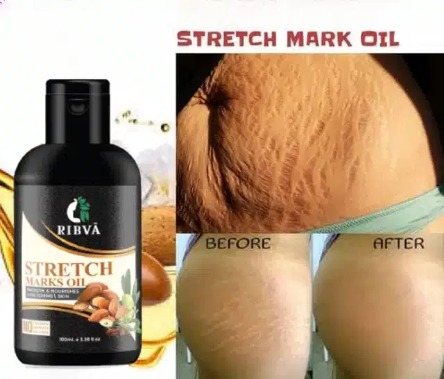 Ribva Body Stretch Marks Remover Oil (100 ml)