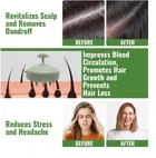 Hair Scalp Massager for Hair Care & Head Relaxation [Multicolor]