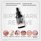 Natural Birth Marks and Blemish Removal Oil 