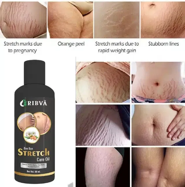 Ribva Stretch Marks Removal Oil (50 ml)
