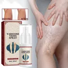 Instant Pain Relief Varicose Vein Spray (30 ml)