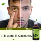 JAUNDICE CURE SYRUP 200ML, Keeps your liver healthy, 