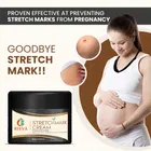 Ribva Stretch Marks Removal Cream 