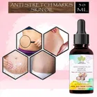 Haria Naturals Anti-Stretch Marks Skin Oil Reduces Stretch Marks & Heal Scars 