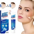 Wart Remover Cream, Massa Removal Cream 