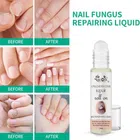 Laugha Nail Fungus Treatment Oil (10 ml)