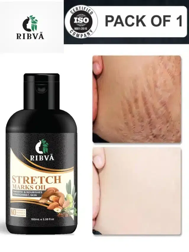 Ribva Stretch Marks Removal Oil (100 ml)