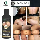 Ribva Body Stretch Marks Remover Cream 