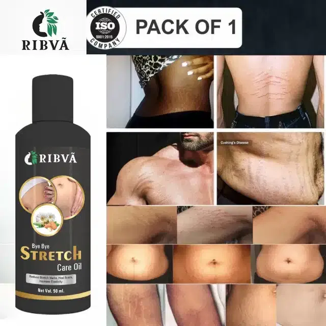 Ribva Body Stretch Marks Remover Cream (50 ml)